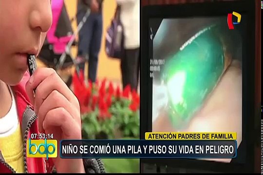 Niño de cuatro años salvó de morir tras ingerir una pila