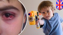 Hard Nerf gun bullets cause serious eye injury