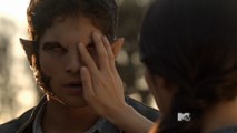 Teen Wolf Season 6 Episode 20 The Werewolves of War - Full HD Streaming Episode Finale