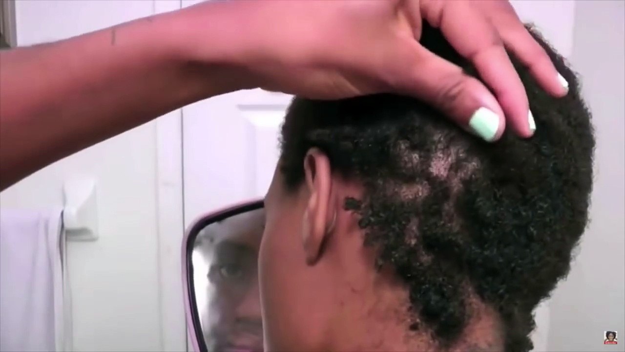 3 Years Natural & Alopecia Free Hair Update | Bald to Full Thick Hair