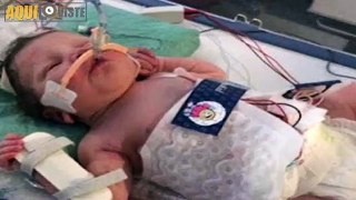Nació muerta a los 5 meses  pero los doctores hicieron algo increíble Mira cómo luce hoy