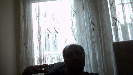 Arka limon tekniği 3