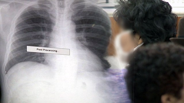 호흡기 질환 사망률 증가... 대기 오염 악화 탓 / YTN