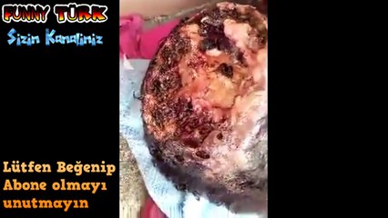 Kafasını beynini parazitler canlı canlı yiyor. Miğdesi hassas olan izlemesin