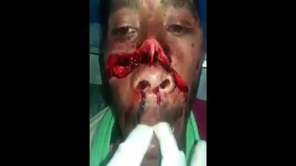DAMN! DISTURBING AFTERMATH OF A MACHETE ATTACK