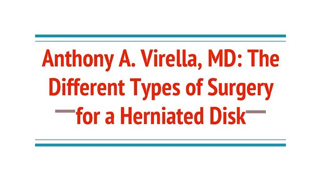 Anthony A. Virella, MD: Surgeries Recommend by Spinal Surgeons
