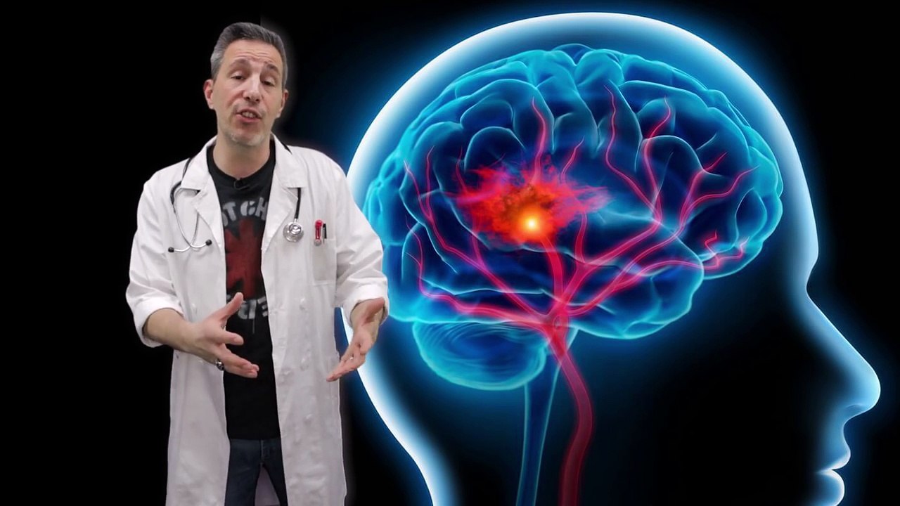 HOW TO FIX A STROKE