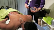 Chinese Cupping Therapy - Does It Hurt?