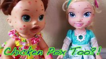 Baby Alive BABY DOCTOR SHOTS ELSA LOST TOOTH & CHICKEN POX Check Up Baby Eli Play Dentist Toy Doll
