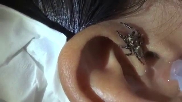 Il avait ça de coincé dans l'oreille... Ouahhhhh