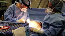Tummy Tuck  Liposuction  Beverly Hills  Dr. Gabriel Chiu