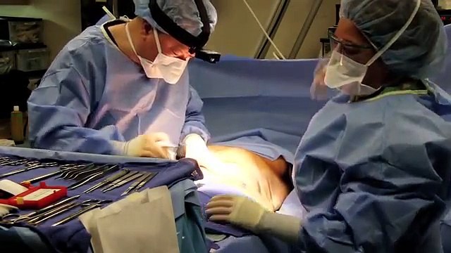 Tummy Tuck Liposuction Beverly Hills Dr. Gabriel Chiu