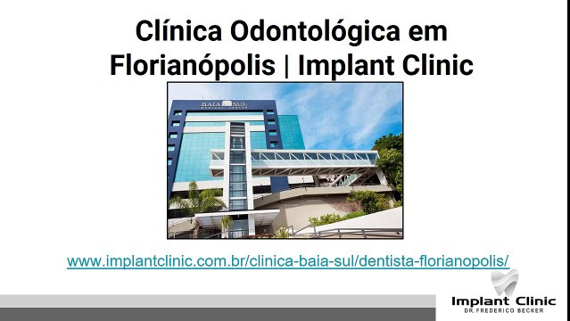 Implantes All-On-4 | Implant Clinic