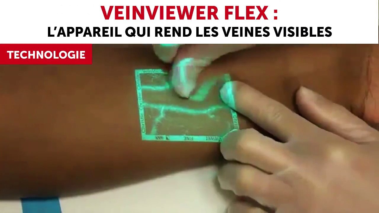 Veinviewer Flex l'appareil qui rend les veines visibles