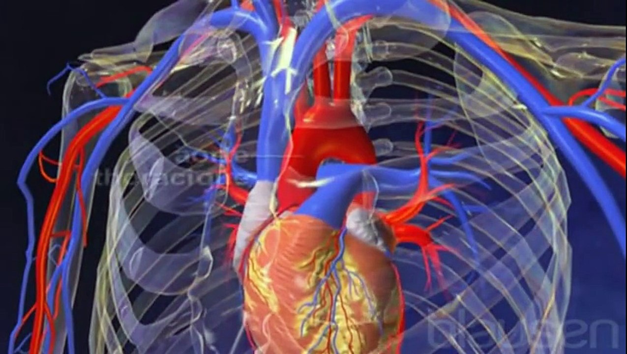 Anévrisme abdominal......مايعرف بالدارجة المغربية بومزوي