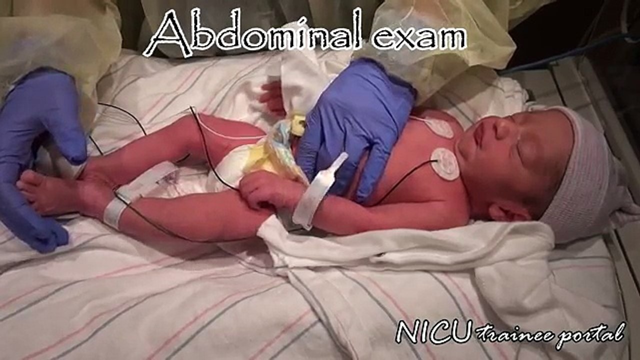 Physical Exam- 35 weeks gestation late preterm infant
