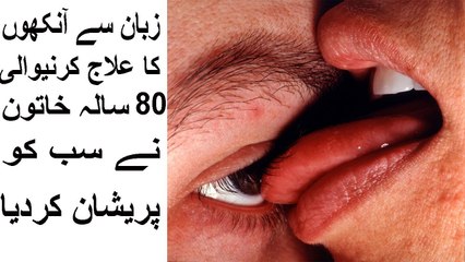 زبان سے آنکھوں کا علاج کرنیوالی 80 سالہ خاتون نے سب کو پریشان کردیا