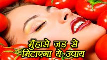 Pimple Removal Treatment | मुँहासे जड़ से मिटाएगा ये उपाय | Home Remedies | Boldsky