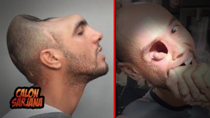 10 MANUSIA PALING UNIK YANG TERLAHIR DI DUNIA!!