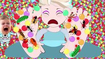 Frozen Elsas GROSS TONGUE! Frozen Elsa has a GROSS TONGUE! Frozen Elsa Eats Bugs Supeheroes IRL!