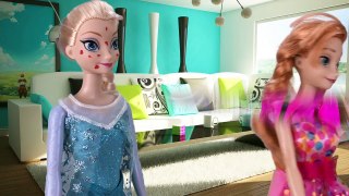 Frozen Elsa Gets Sick! You Vote How to Make Her Better with Frozen Anna and Barbie Plus Descendants
