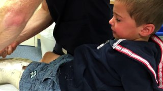 Elliots Broken Leg | getting a new cast!