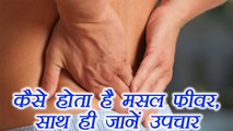 Muscle Fever Home Remedies : कैसे होता है मसल फीवर, जानें उपचार | Boldsky