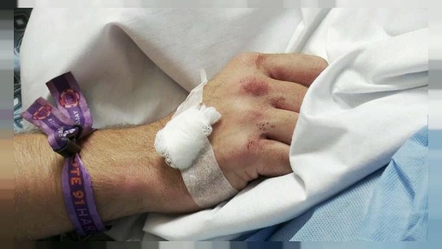 Testigo del horror: un herido cuenta cómo vivió el tiroteo de Las Vegas