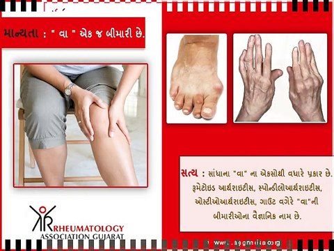 What is Arthritis? Know about Arthritis Symptoms and Treatment from RAG