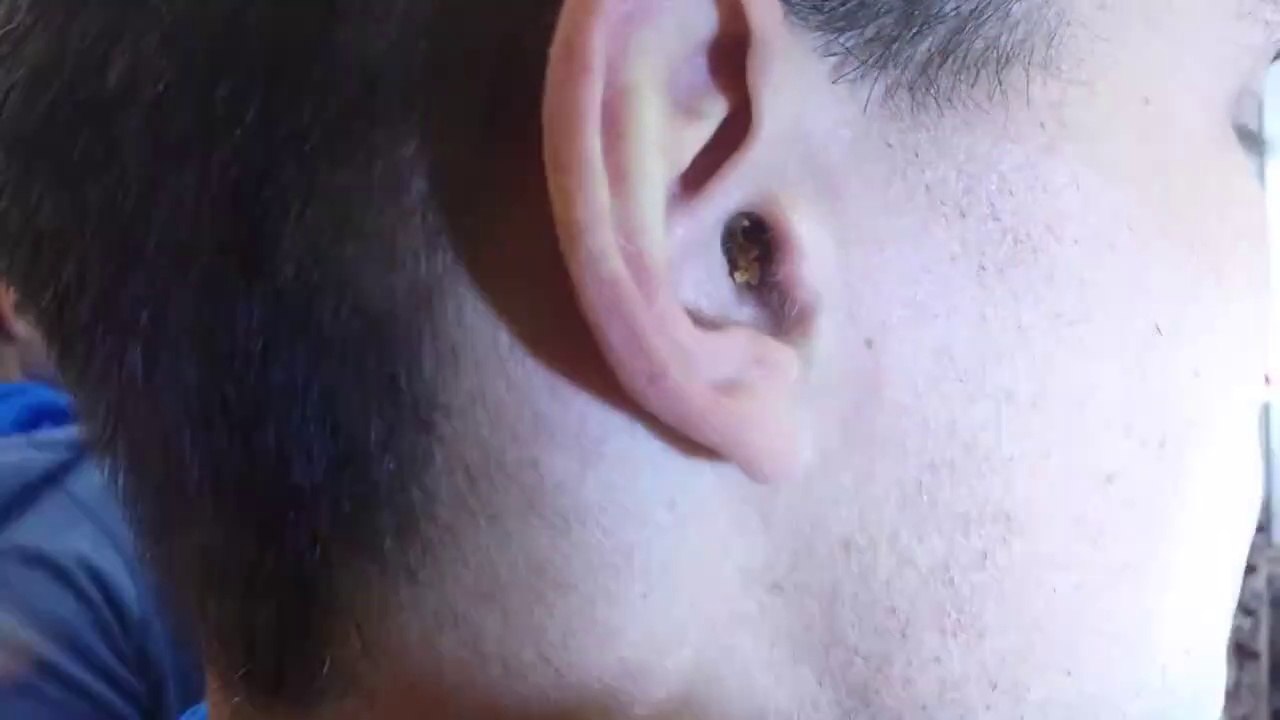 Elle retire un ÉNORME bouchon de cérumen de l'oreille de son copain