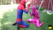 Pink Spidergirl Loses Her Eyes w/ Spiderman, Hulk vs Crazy Doctor Super Heroes in Real Life in 4K