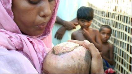 UN: Rohingya face world’s most urgent refugees crisis