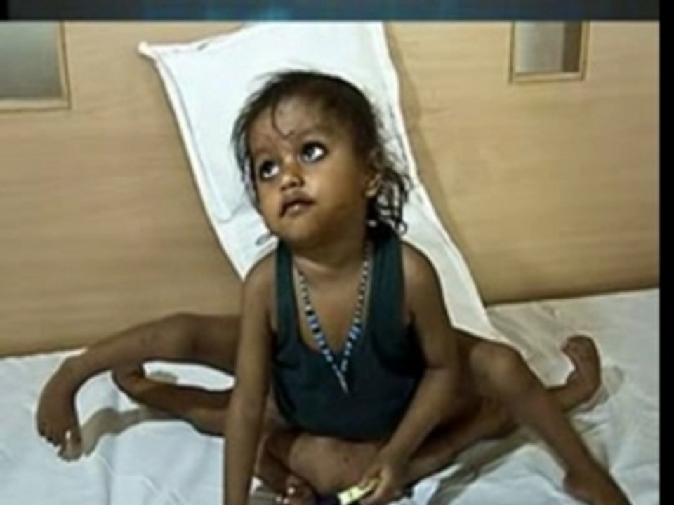 Quatre bras + quatre jambes