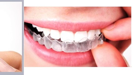 Invisalign Las Vegas