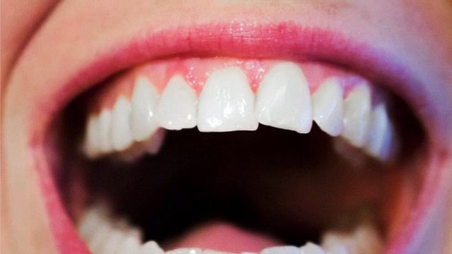 North Las Vegas Orthodontist