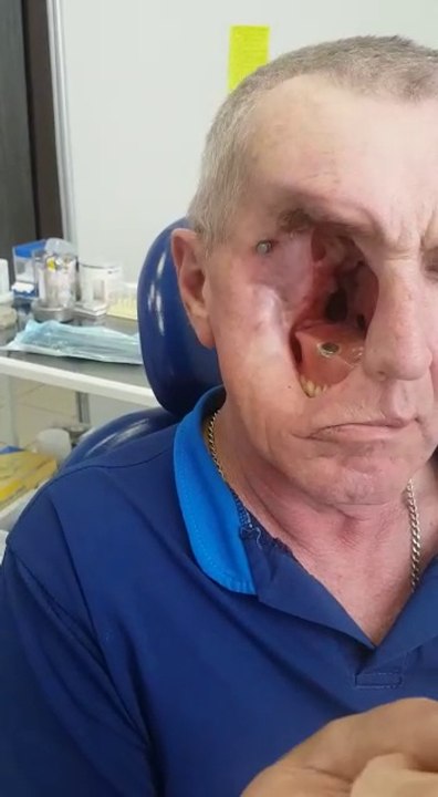 Man With Duplicate Face