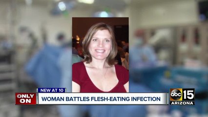 Valley woman battling flesh eating infection