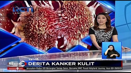 Derita Kanker Kulit di Wajah