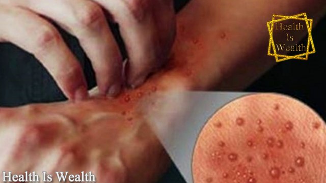 10 Amazing Uses & Benefits Of Alum | Fitkari For Health, Hair & Skin | Health Is Wealth