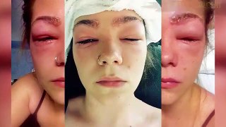 Cette belle jeune fille  a voulu colorer ses sourcils, mais elle a failli devenir aveugle