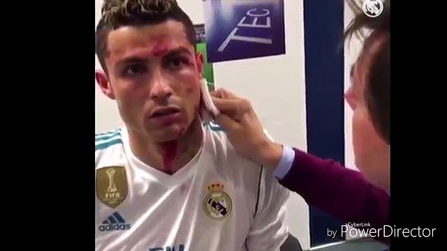Real Madrid reveal behind the scenes footage of Cristiano Ronaldo as medics treat his bloody head in