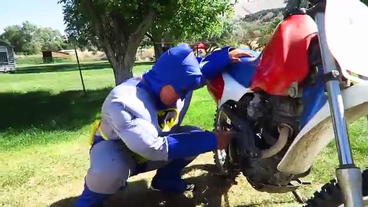 Spider-man vs Dentist Doctor Superman! Spiderman loses his tooth! Funny Superhero Video in Real Life