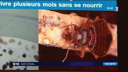 Santé : gare aux punaises !
