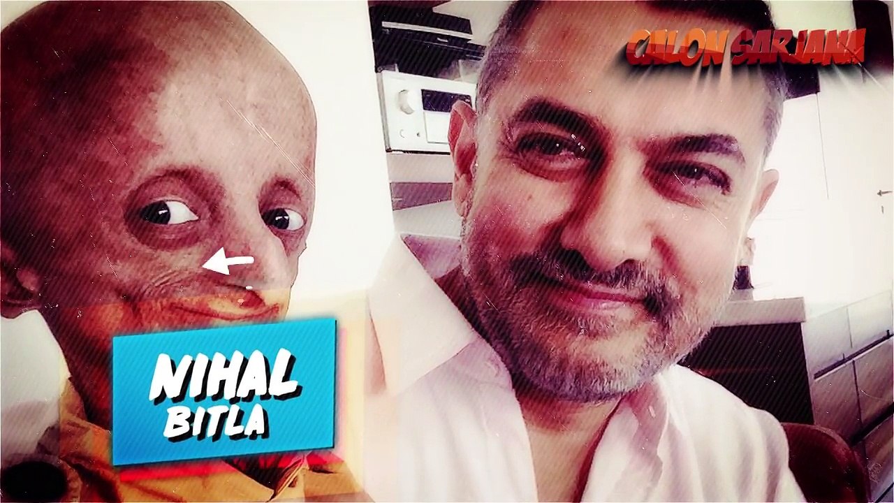 10 ANAK PALING UNIK DAN ANEH YANG SULIT DIPERCAYA ADA DI DUNIA!!!