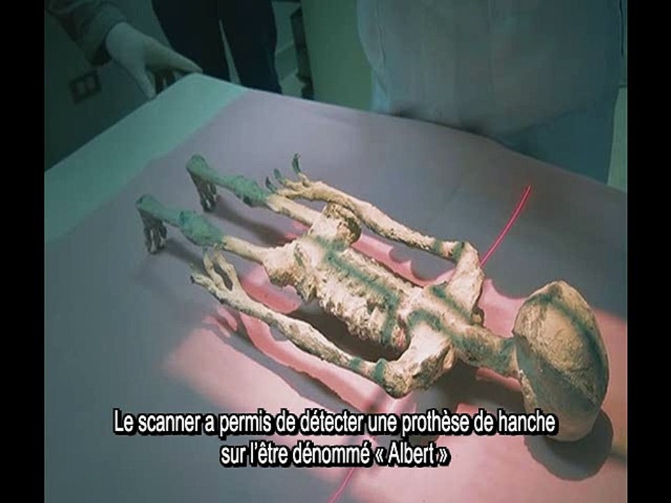 Les Etres mystérieux de Nasca - Analyse de la hanche d'Albert par le Dr R. Salas Alfaro - N° 6 - Analyses