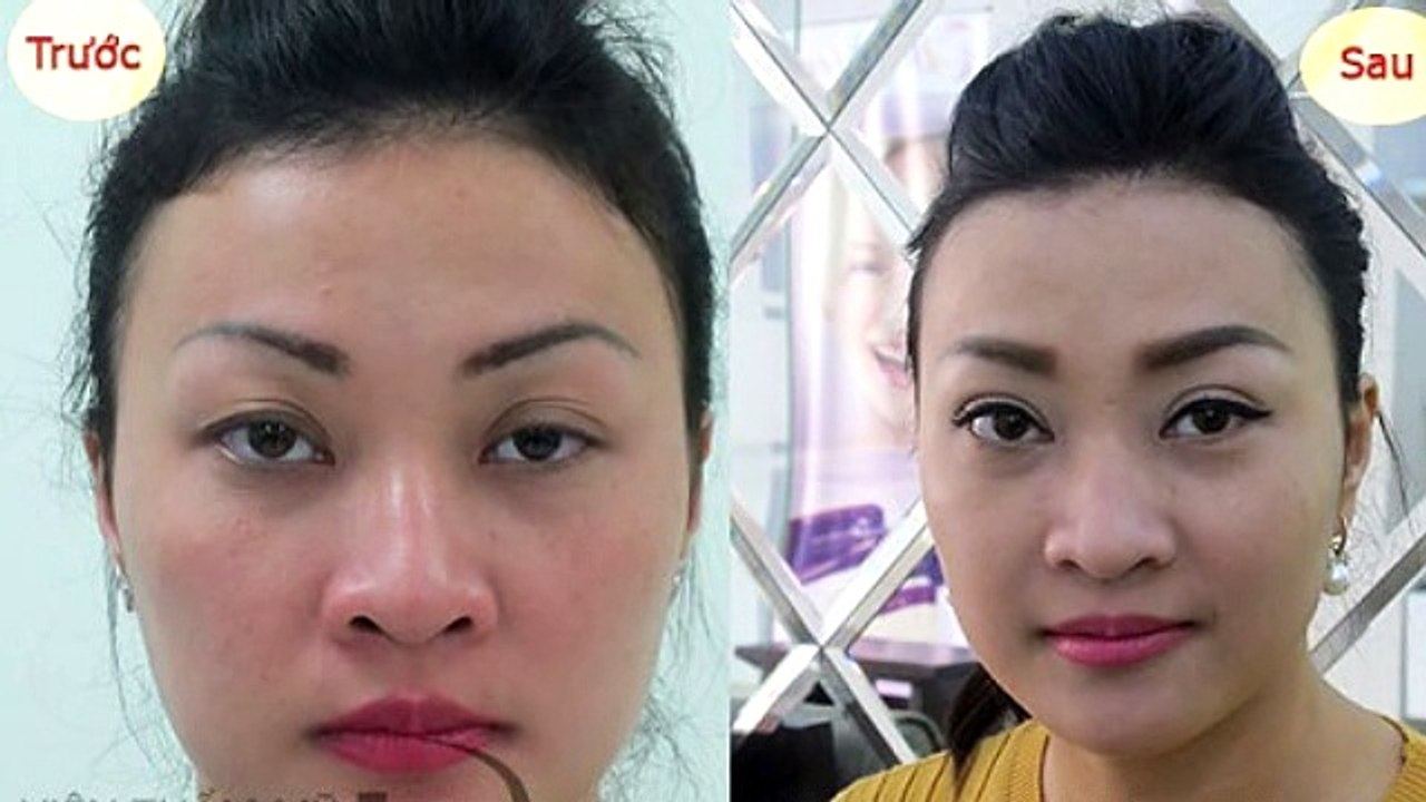 Các mẹ có biết địa chỉ nào nhấn mí ở đâu đẹp không?