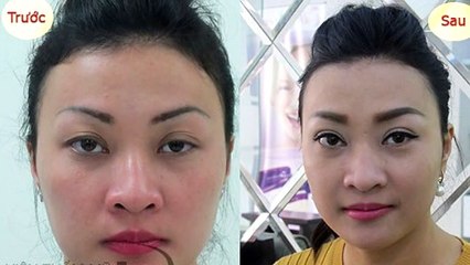Các mẹ có biết địa chỉ nào nhấn mí ở đâu đẹp không?