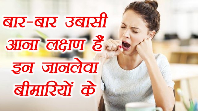 Yawning Disease: बार-बार उबासी आना लक्षण हैं इन जानलेवा बीमारियों के | Excessive Yawning | Boldsky