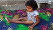 Indian girl whose bones have fractured 14 times hopes to be able to stand one day 
