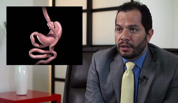 Gastric Bypass - Tijuana, Mexico - Monterrey, Mexico